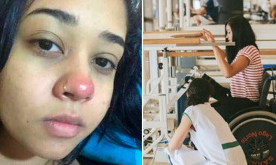 Girl Becomes Paralysed After Piercing Her Nose Due To Bacterial Infection - World Of Buzz