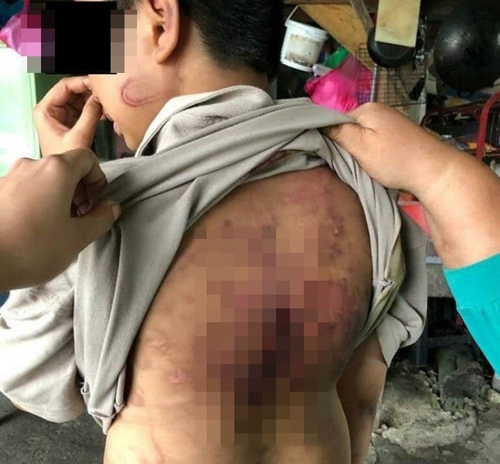 Johorean Boy Abused by Stepfather and Mum with Rice Cooker Cable - WORLD OF BUZZ