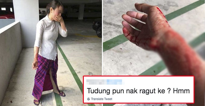 malindo air crew injured at parking lot robbery salty netizens focus on her uniform instead world of buzz 2