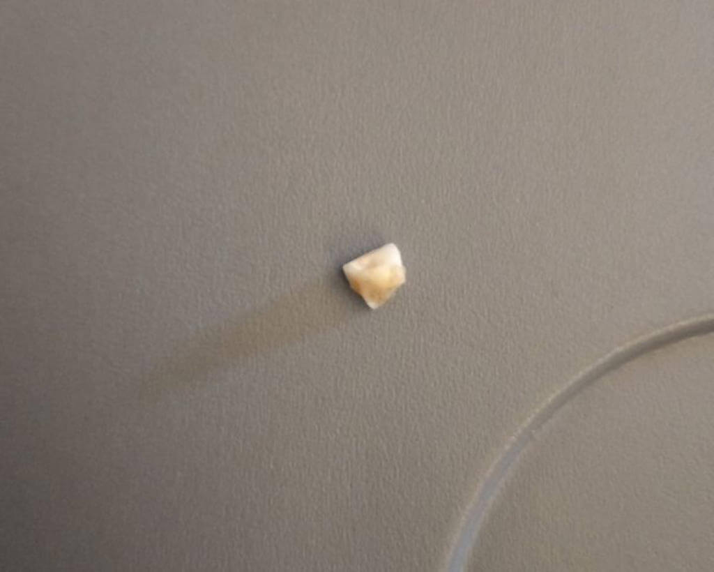 Singaporean Airlines Investigating After Passenger Finds Tooth In His Rice Meal - WORLD OF BUZZ