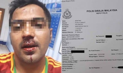 Teacher In Banting Allegedly Dates A 19Yo, Gets Punched In The Face By Her Uncle - World Of Buzz