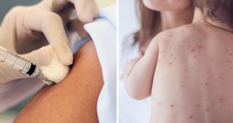This Country Was Measles-Free For 5 Years Until An Unvaccinated Child Recently Went There On Vacation - World Of Buzz 5