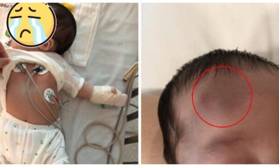 This Poor Infant Now Has Blood Clots And 2 Broken Bones After His Nanny Dropped Him Down The Stairs - World Of Buzz 3