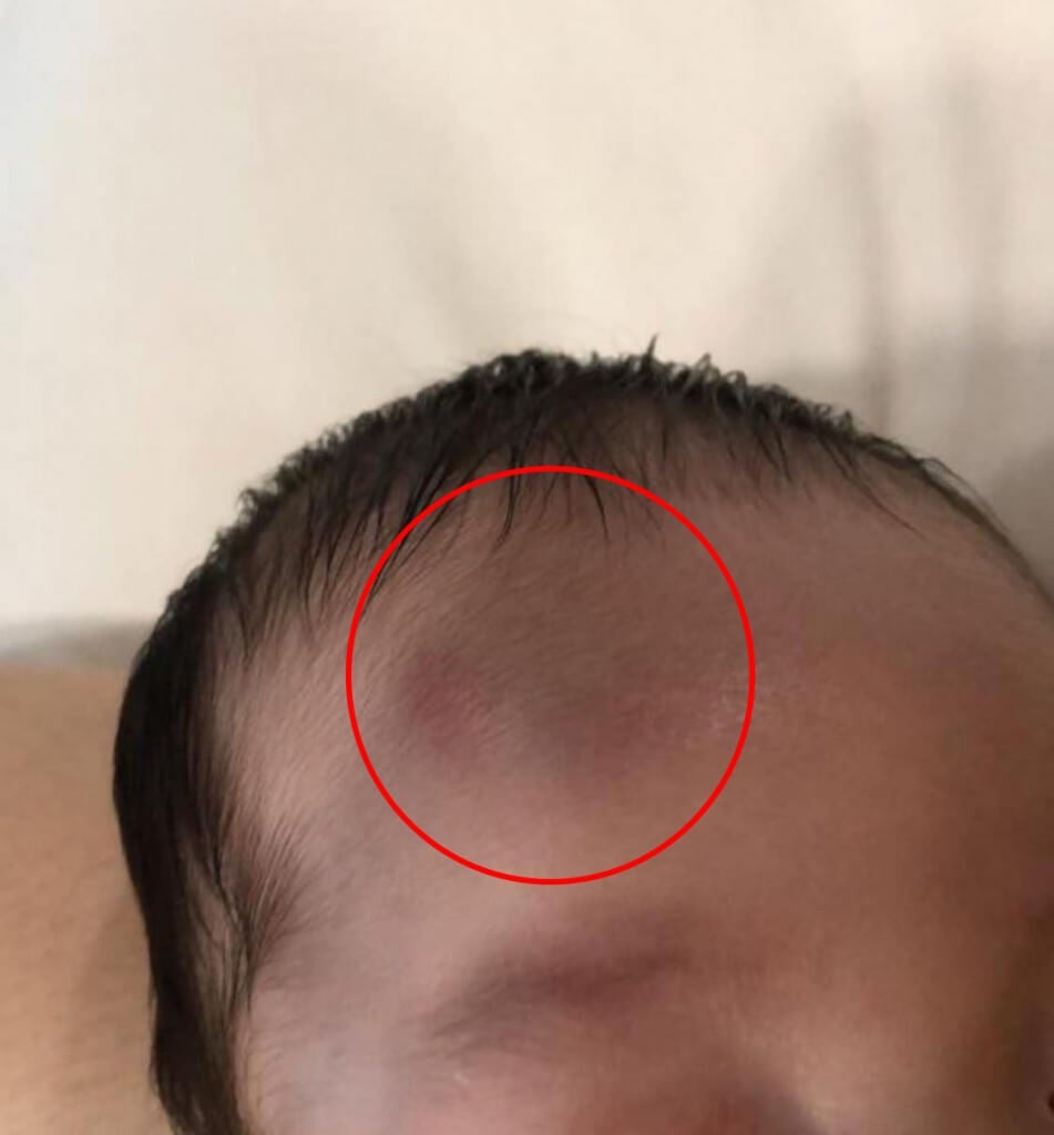 Baby Suffers Blood Clots in Brain After Nanny From SS2 Confinement