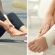Woman'S Sprained Ankle Causes Her To Fall Into Coma &Amp; Tragically Dies Just 12 Days Later - World Of Buzz 2