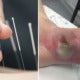 Diabetic Man Loses Leg After Using Traditional Chinese Medicine, Unsympathetic Practitioner Suspended - World Of Buzz 3