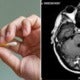 Man Suffers From Potentially Deadly Brain Infection After He Used Cotton Bud To Clean His Ears - World Of Buzz 5