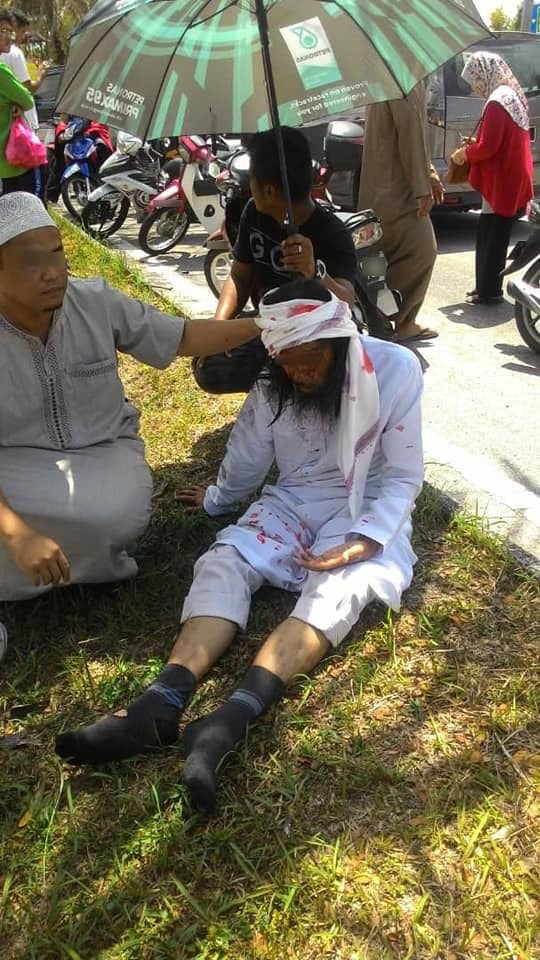 M'sian Injured & Bleeding From Motorbike Fall After He Encounters Suspicious Oil Slick on Selangor Road - WORLD OF BUZZ