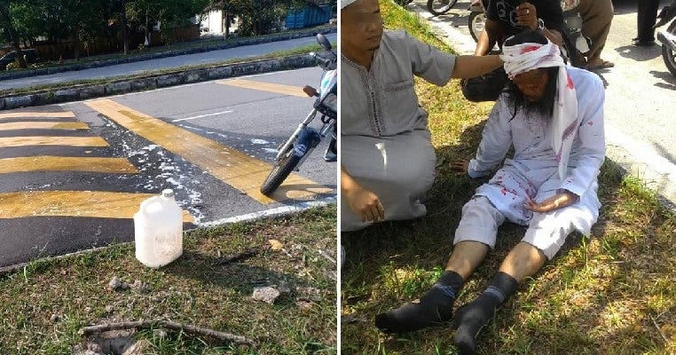M'Sian Injured From Motorbike Fall After He Encounters Suspicious Oil Slick On Selangor Road - World Of Buzz 2