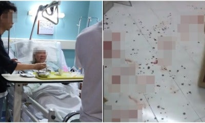 M'Sian Woman Badly Injured After Getting Hit With Metal Rod By Stranger While Taking Out Trash - World Of Buzz