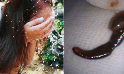 Woman Washes Face With Spring Water While Hiking, Leech Ends Up Slipping In Her Nose - World Of Buzz 1