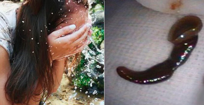 Woman Washes Face With Spring Water While Hiking, Leech Ends Up Slipping In Her Nose - World Of Buzz 1