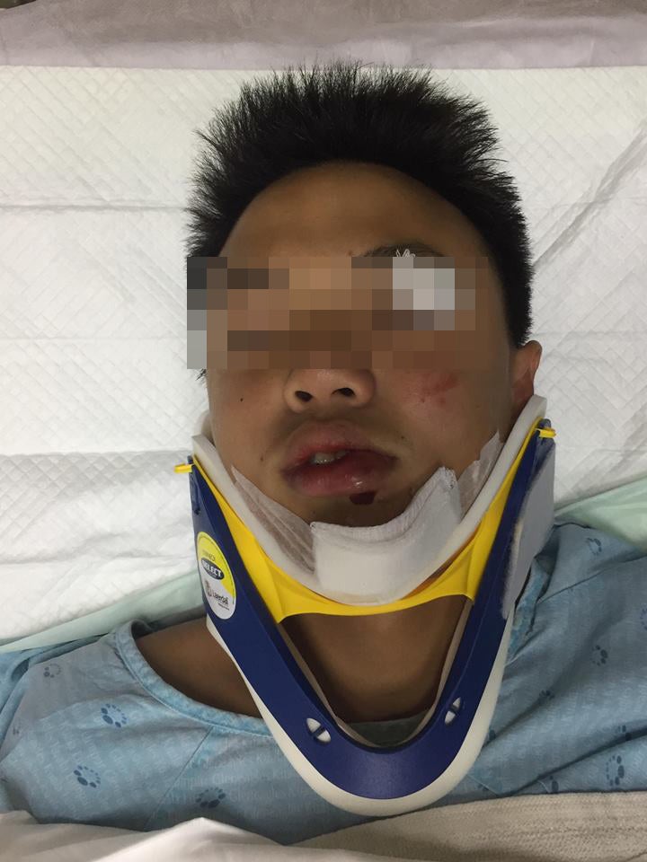 14yo Student Gets Assaulted & Rushed to Hospital, School Tells Parents He "Had A Seizure" Instead - WORLD OF BUZZ 1