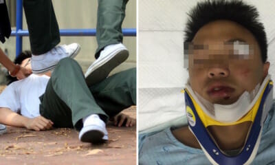 14Yo Student Gets Assaulted &Amp; Rushed To Hospital, School Tells Parents He &Quot;Had A Seizure&Quot; Instead - World Of Buzz 2