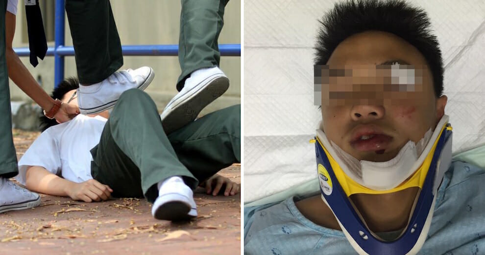 14Yo Student Gets Assaulted &Amp; Rushed To Hospital, School Tells Parents He 
