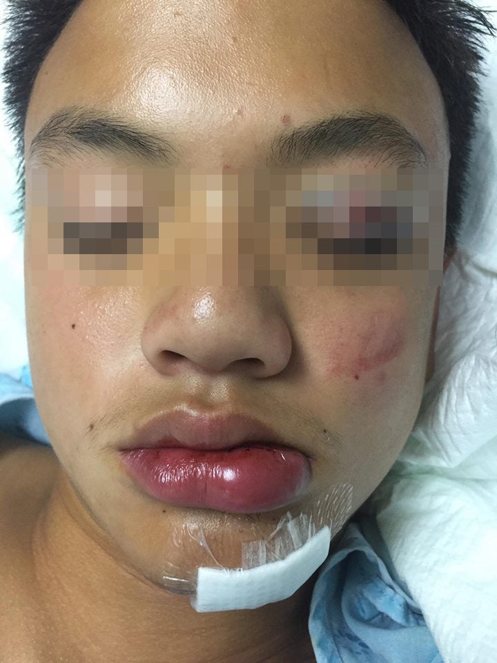 14yo Student Gets Assaulted & Rushed to Hospital, School Tells Parents He "Had A Seizure" Instead - WORLD OF BUZZ