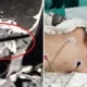 3Yo Girl Gets Chopstick Pierced Through Her Skull As She Was Playing While Eating - World Of Buzz 2