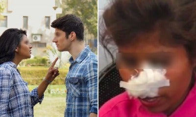 Ex-Bf Viciously Bites Off Woman'S Nose &Amp; Severely Injures Her After She Rejected Him Again - World Of Buzz 1