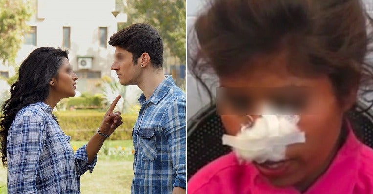 Ex-Bf Viciously Bites Off Woman'S Nose &Amp; Severely Injures Her After She Rejected Him Again - World Of Buzz 1