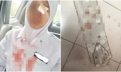 Johor Nurse Suffered Childhood Phobia Irl When An Old Fan Blade Fell And Injured Her - World Of Buzz 1