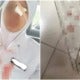 Johor Nurse Suffered Childhood Phobia Irl When An Old Fan Blade Fell And Injured Her - World Of Buzz 1