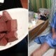 Man Loses Both Legs After He Contracted Deadly Infection From Eating Pig'S Blood - World Of Buzz 3