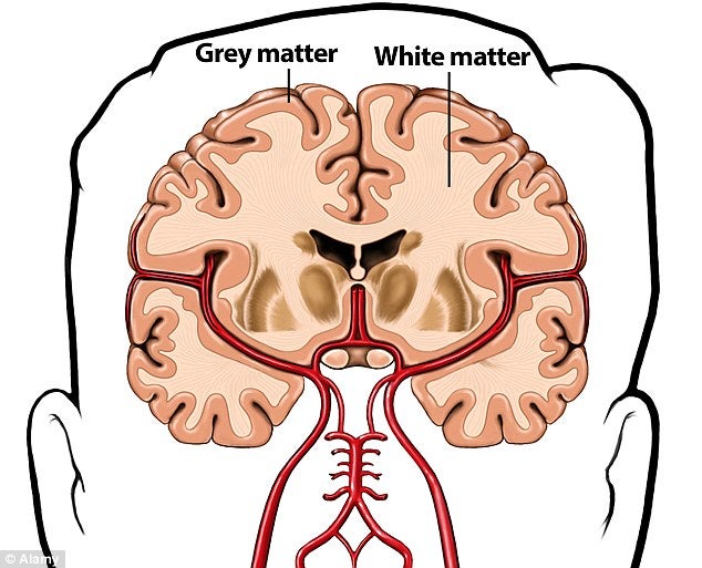 Study Shows The Rounder Your Bellies, The Smaller Your Brain May Become - World Of Buzz 1