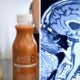 Woman Prescribed 3-Week Juice &Amp; Water Cleanse By &Quot;Alternative Therapist&Quot;, Suffers Brain Damage - World Of Buzz 2