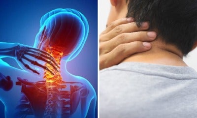 Beware: 28Yo Man Suffers Severe Stroke Because He Stretched &Amp; Popped His Neck - World Of Buzz 3