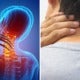 Beware: 28Yo Man Suffers Severe Stroke Because He Stretched &Amp; Popped His Neck - World Of Buzz 3