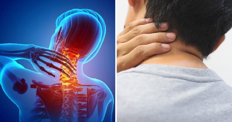 Beware: 28yo Man Suffers Severe Stroke Because He Stretched & Popped His Neck - WORLD OF BUZZ 3