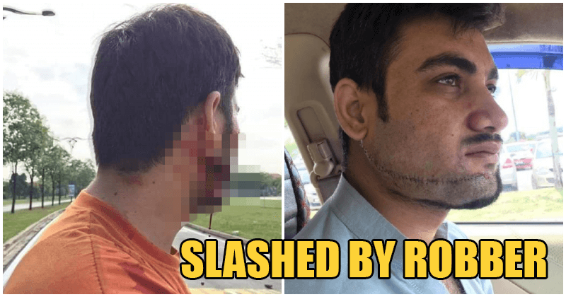 Foreign Worker Brutally Slashed In The Face By Robbers On Motorcycles In Shah Alam - World Of Buzz