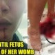 Husband Beats Wife Until Her She Miscarriages And Her Fetus Falls Out - World Of Buzz