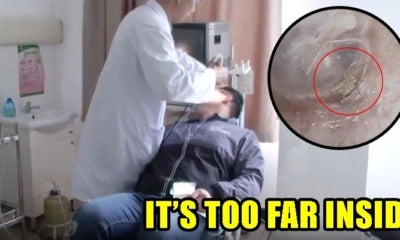 Spider Found Webbing Inside A Man'S Ear, Goes To Doctor For Help - World Of Buzz 1