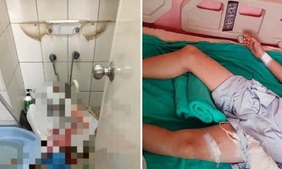10Yo Boy Seriously Injured &Amp; Severs 8 Nerves After Toilet Sink He Was Pressing On Suddenly Fell Off - World Of Buzz 4