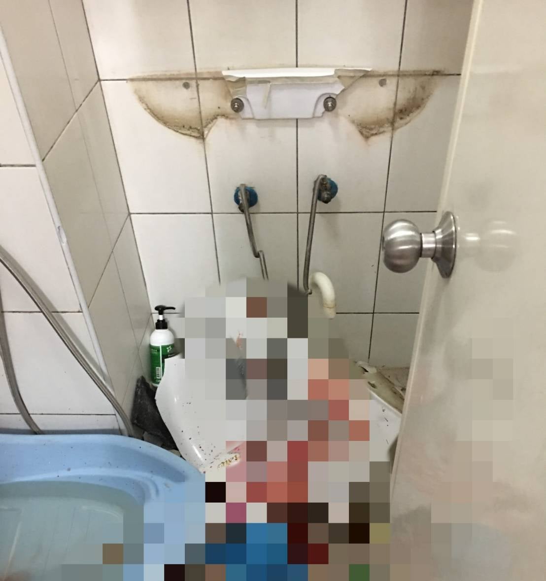 10yo Boy Seriously Injured & Severs 8 Nerves After Toilet Sink He Was Pressing On Suddenly Fell - WORLD OF BUZZ