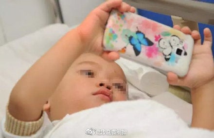 2Yo Girl Suffers From 900-Degree Short-Sightedness After Using Smartphone For Over A Year - World Of Buzz