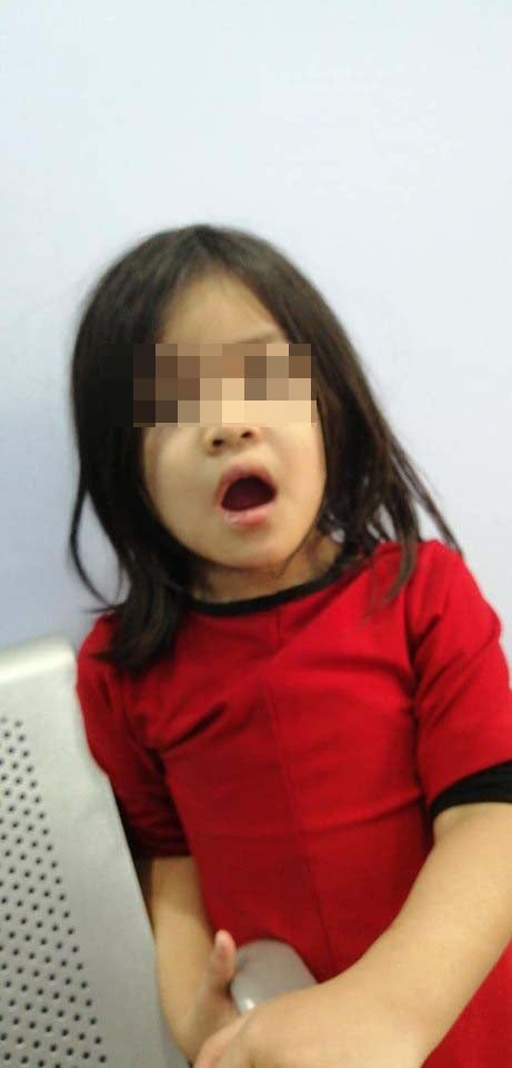 4yo M'sian's Mouth Experiences Spasms, Swelling & Numbness After Biting Common Houseplant - WORLD OF BUZZ 1