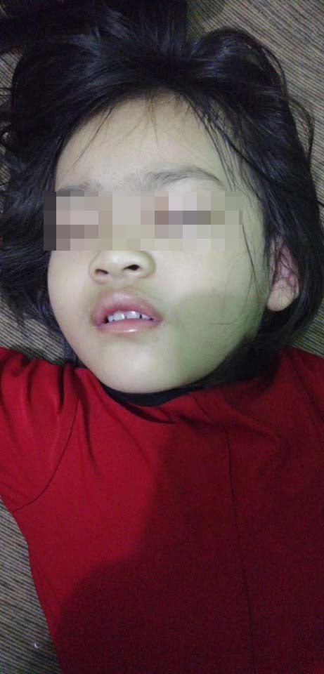4Yo M'sian's Mouth Experiences Spasms, Swelling &Amp; Numbness After Biting Common Houseplant - World Of Buzz
