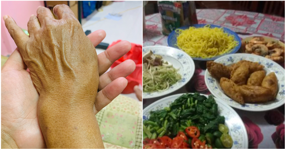 Aunty With Broken Wrist Cooked For Raya Her Guests But They Did Not Show Up - World Of Buzz 2