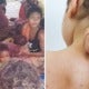 Deaths Among Orang Asli Were Due To Measles, Ministry Of Health Explains Importance Of Vaccines - World Of Buzz