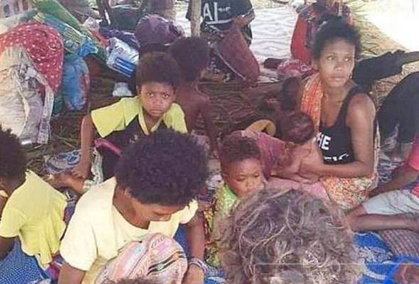 Deaths Of Orang Asli Due to Measles Outbreak, Ministry Of Health Explains Importance Of Vaccines - WORLD OF BUZZ