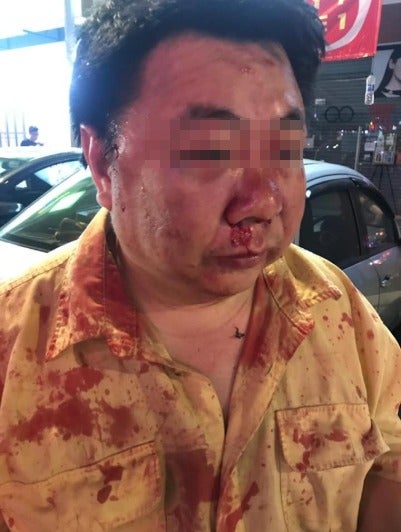 Malaysian Man Brutally Beats Another Guy At Cheras C180 Allegedly Due To Road Accident - World Of Buzz