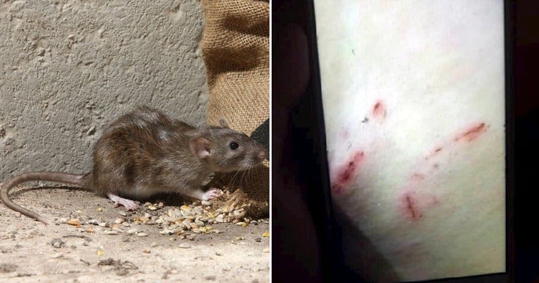 Malaysian Teen Gets Bitten By Rat On Her Thigh After The Rodent Crawled Up Her Jeans - World Of Buzz 2