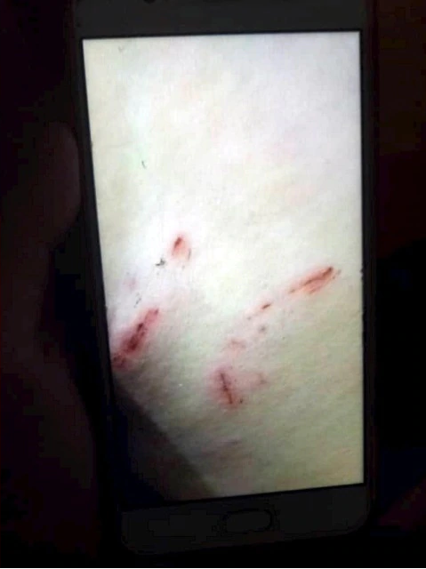 Malaysian Teen Gets Bitten By Rat on Her Thigh After The Rodent Crawled Up Her Jeans - WORLD OF BUZZ 1