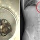 Man Gets So Drunk He Lost His Keys, Turns Out He Swallowed Them Instead - World Of Buzz 2
