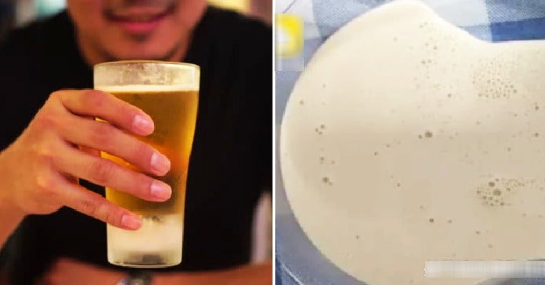 This Man Loves to Drink Beer Every Day Until Doctor Extracted Thick White Fluid From Swollen Knee Joint - WORLD OF BUZZ 4