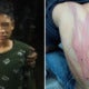 13Yo Penang Boy Reportedly Beaten Up For Stealing Cigarettes, Parents File Police Report - World Of Buzz