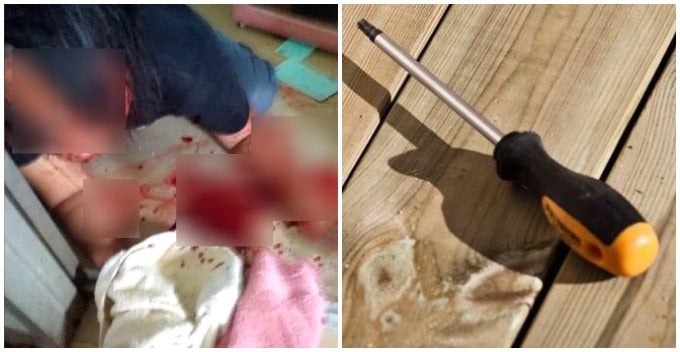31Yo Terengganu Man Stabbed Ex-Wife With Screwdriver Because She Refused To Reconcile - World Of Buzz 1