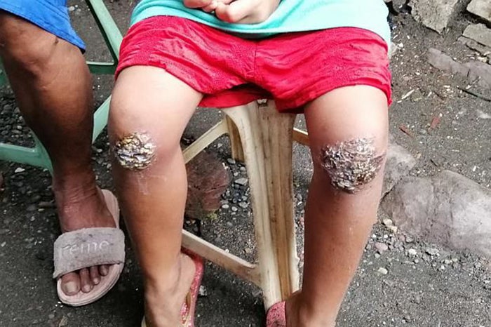 8yo Philippine Girl Forced to Kneel on Embers For Forgetting to Bring Her Bag Home - WORLD OF BUZZ 2